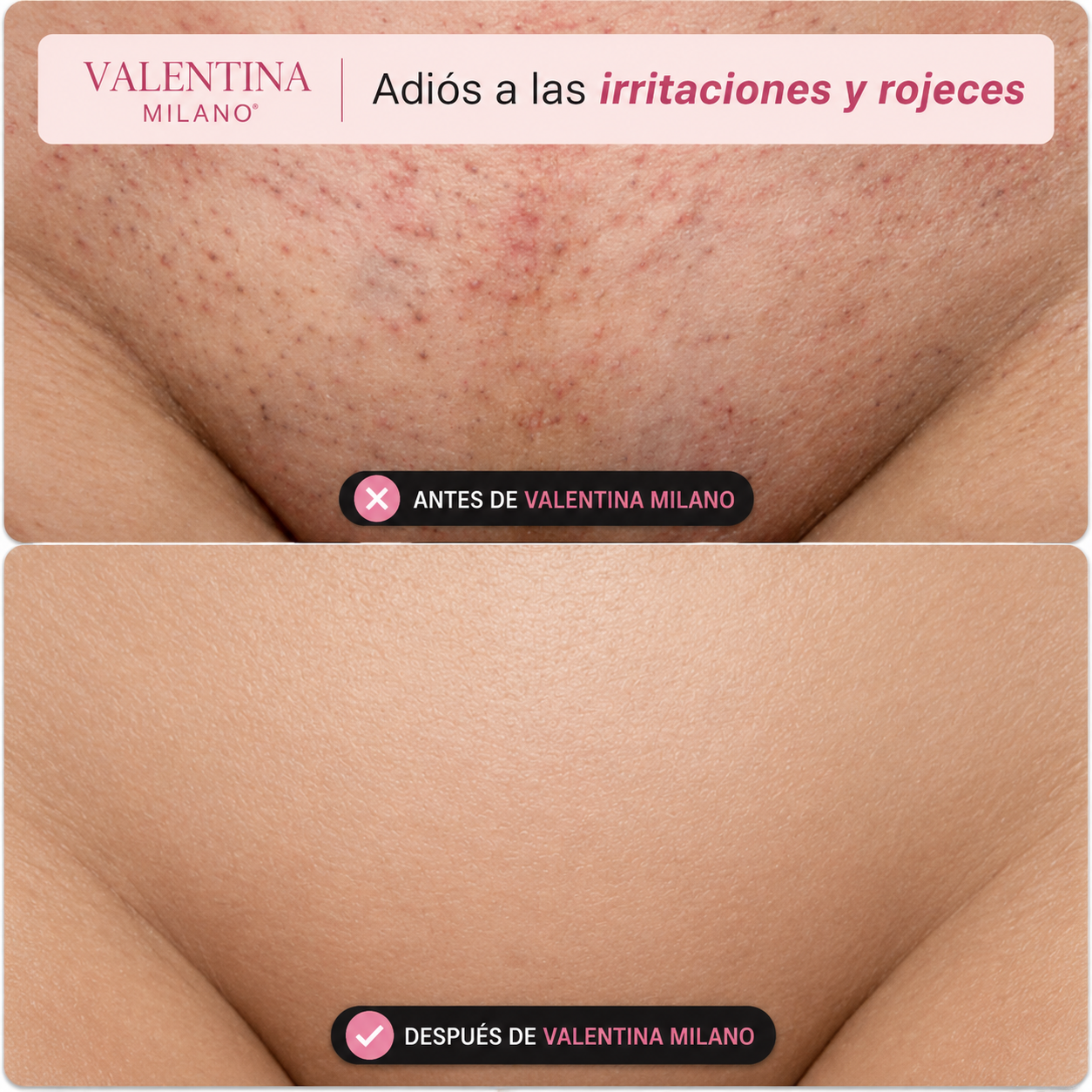 Olvídate de la irritación. Descubre una nueva forma de depilarte.