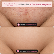 Olvídate de la irritación. Descubre una nueva forma de depilarte.
